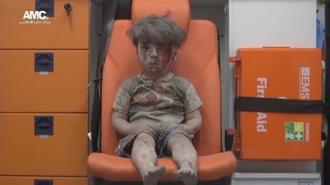 Recently the group helped distrubute this picture of Omran Daqneesh. The image of him, bloodied and silent while awaiting help, vividly reminded the world of the horrors those in Aleppo are facing.