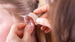 young hearing loss hearing aid RESTRICTED