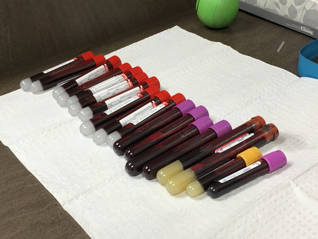 Eighteen vials of blood are drawn before the first injection, and half are frozen for future use.