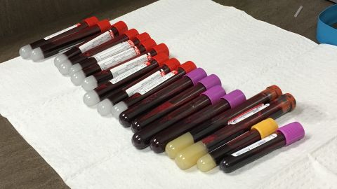 Eighteen vials of blood are drawn before the first injection, and half are frozen for future use.