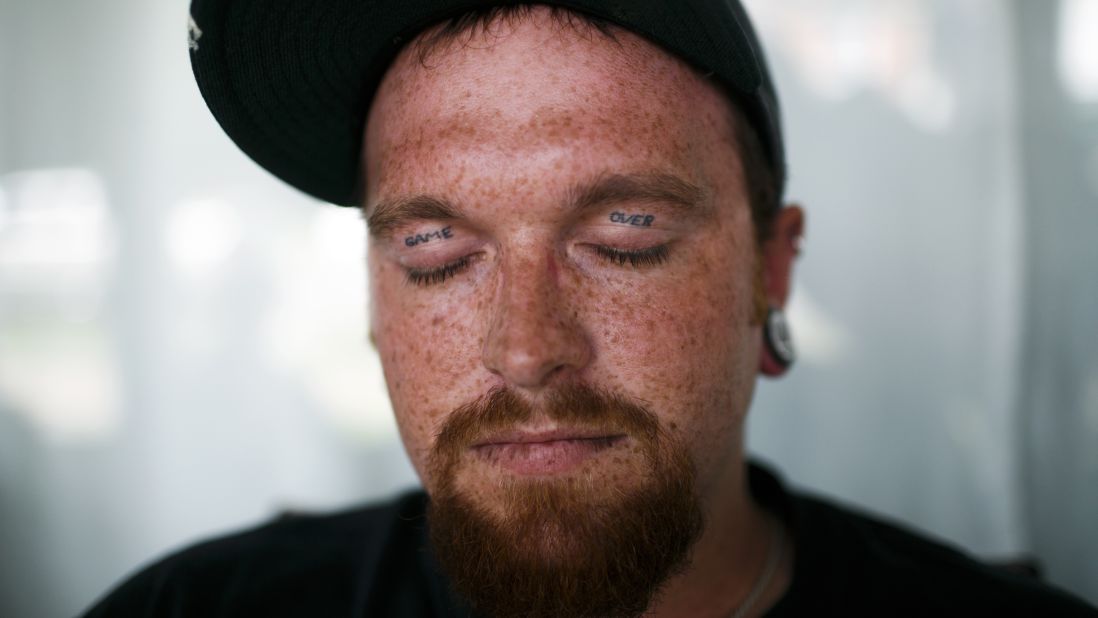James Blevins, 28, has "Game Over" tattooed on his eyelids. Blevins has been sober for four months and lives in one of The Lifehouse recovery homes in Huntington.