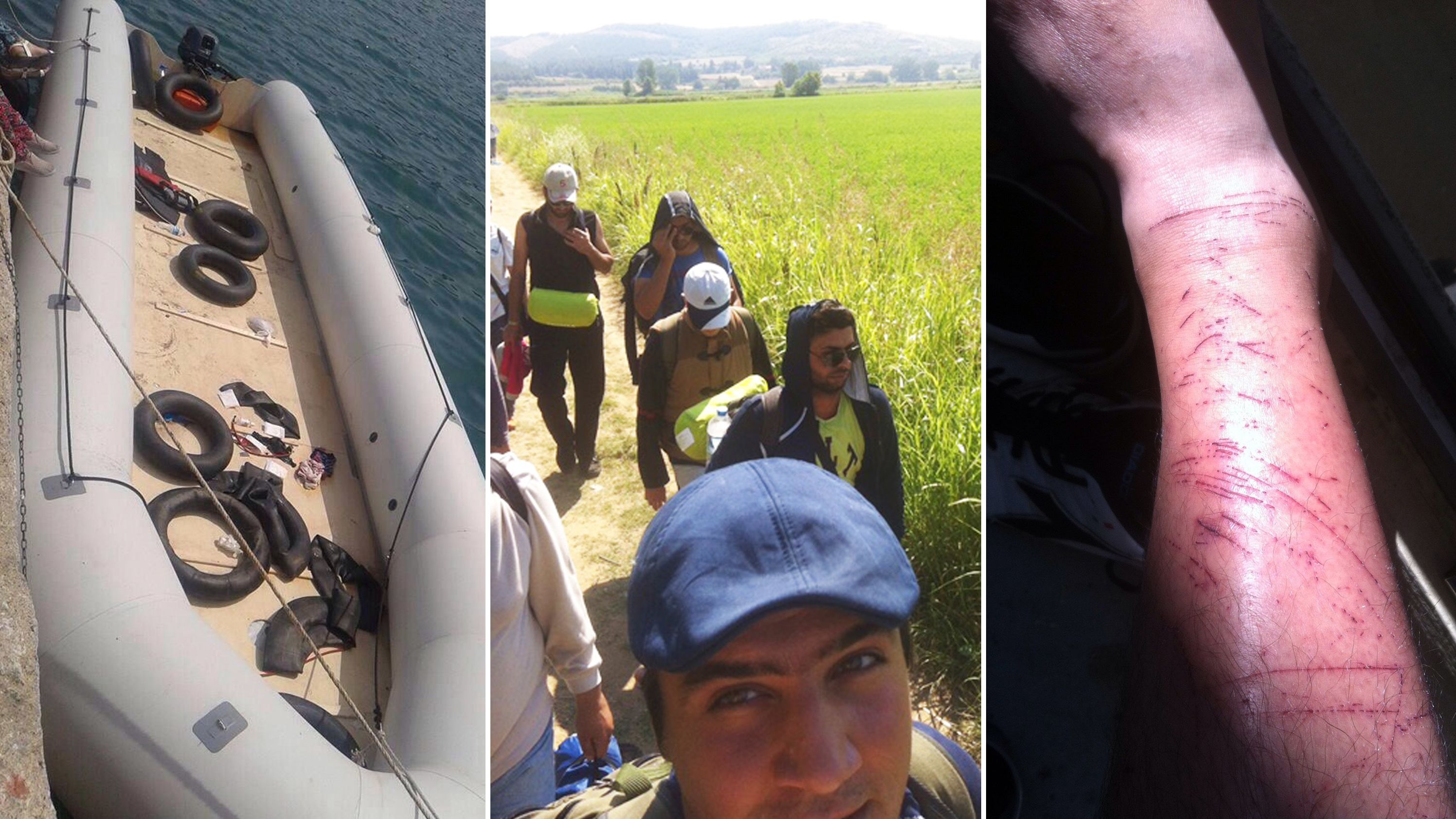 Left: A boat similar to the one Batal took from Turkey to Greece. Center: Walking through Greece to the Macedonian border. Right: The young man's legs covered in scratches after attempting to scale a razor wire fence into a Calais train station. 