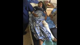 Mahmud Jassim was shot in the leg by a sniper on the first day of the ceasefire.
