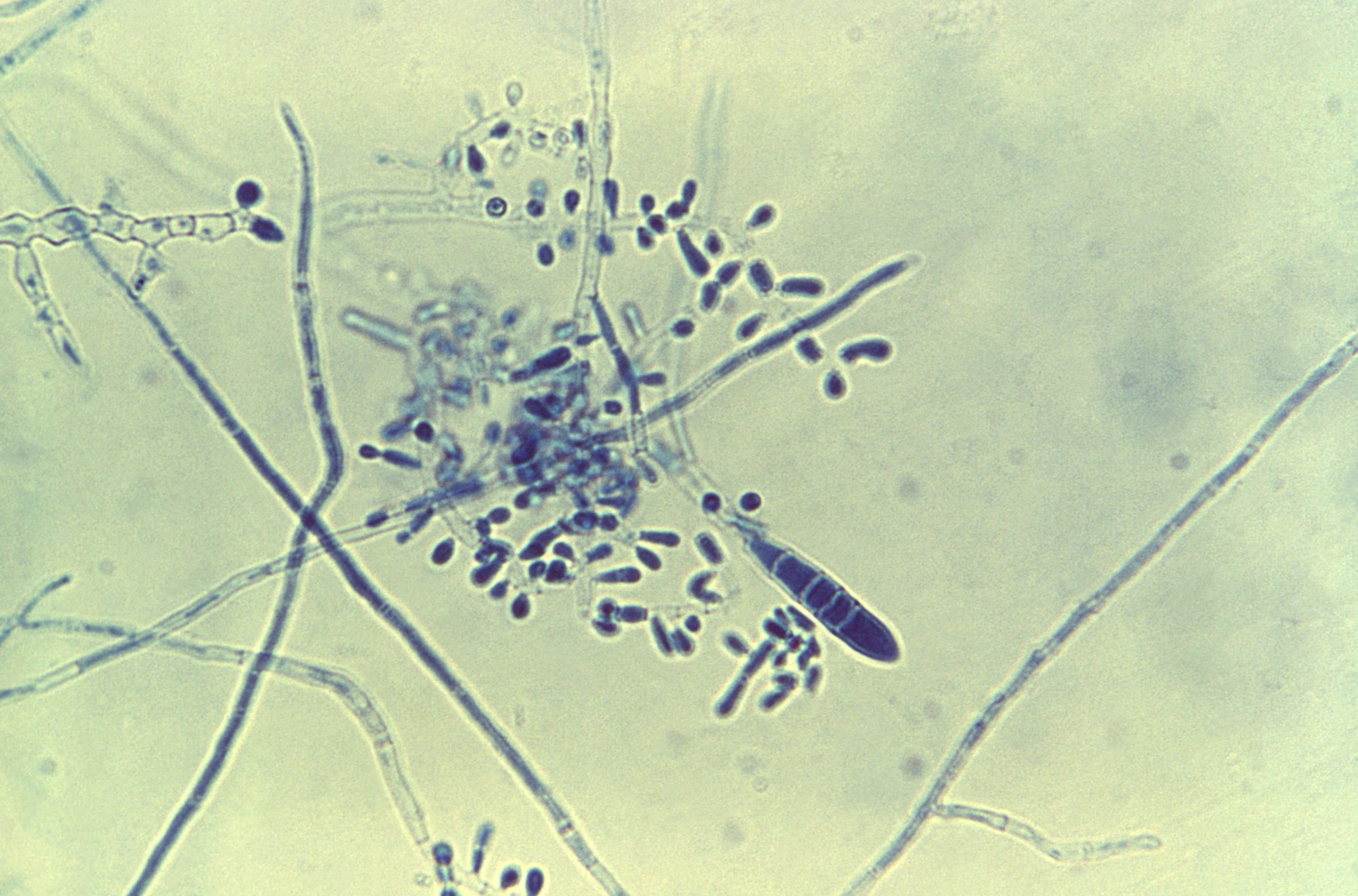fungus on feet microscopic
