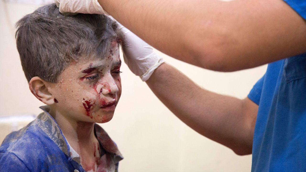 A Syrian boy receives treatment at a make-shift hospital following air strikes on rebel-held eastern areas of Aleppo on September 24, 2016.