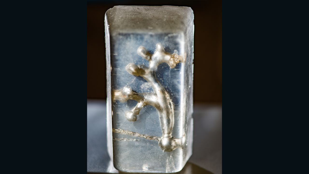 The silicone cast of the inside of a kidney.