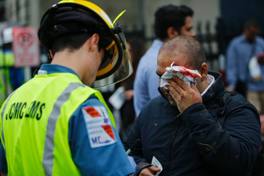 A man hurt in the crash is treated for a facial injury. 