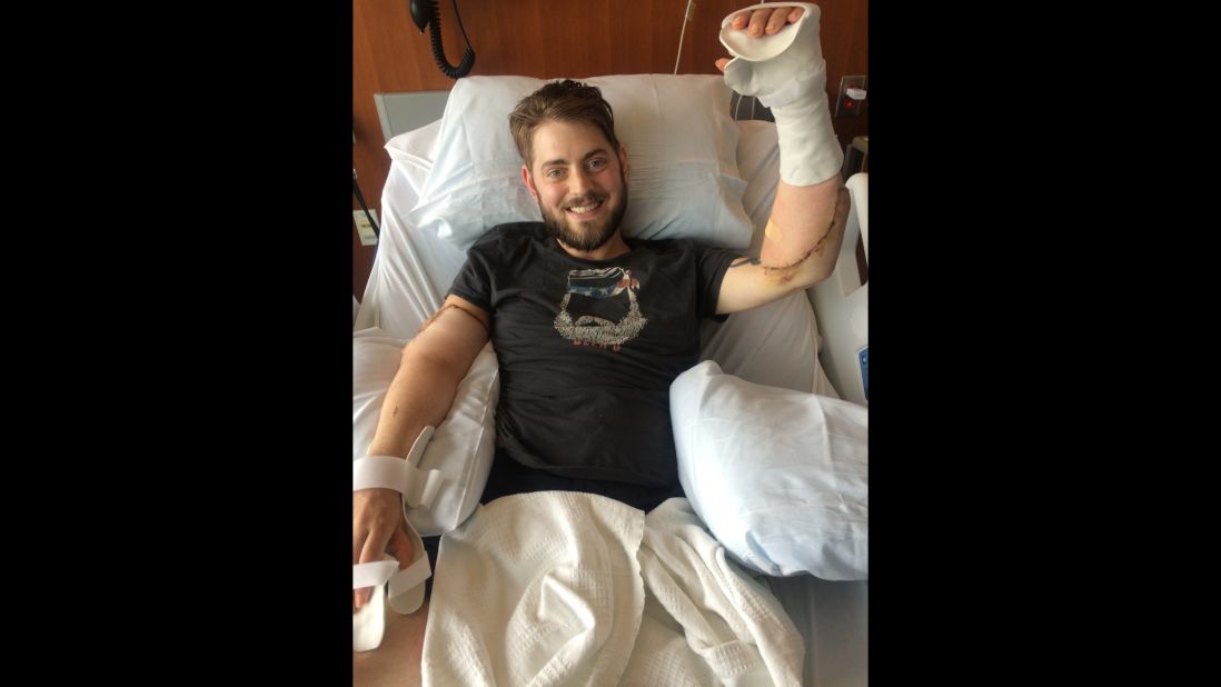 Peck's bilateral arm transplant surgery was successful, surgeons said.