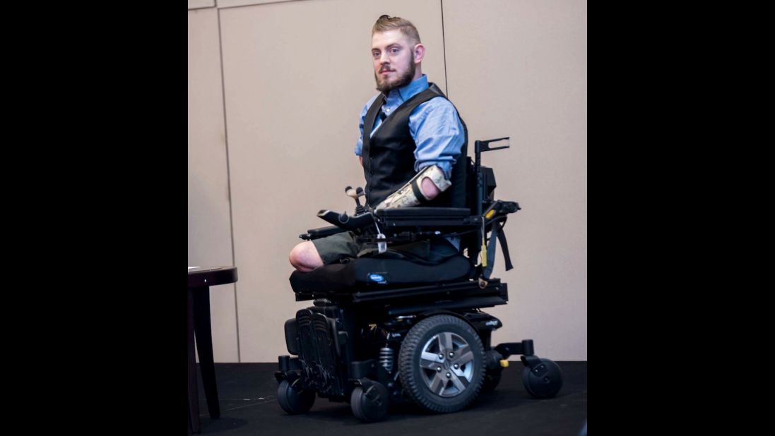 In 2014, Peck learned that he was approved for a bilateral arm transplant.