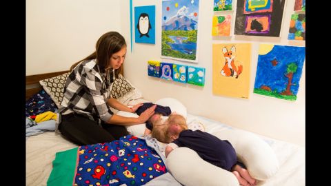 Doctors have placed what's called tissue expanders into the boys' heads. The expanders gradually get filled with fluid ahead of the surgery to stretch their skin.