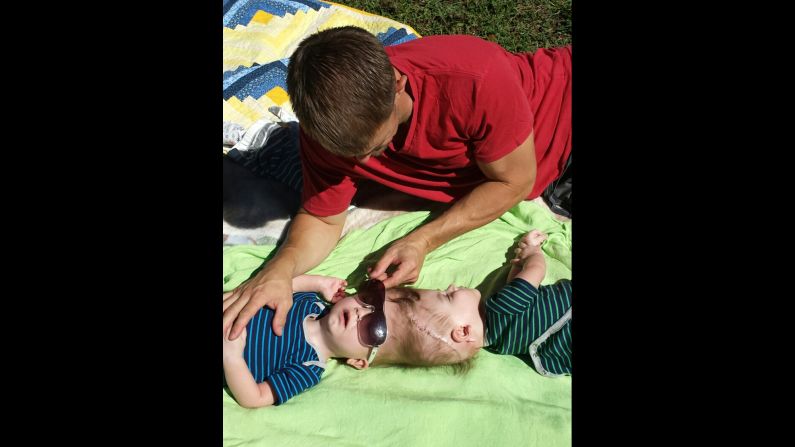 "I can't wait to see them as two separate little boys," said Christian. "That's what excites me the most. I really just want to know my boys."