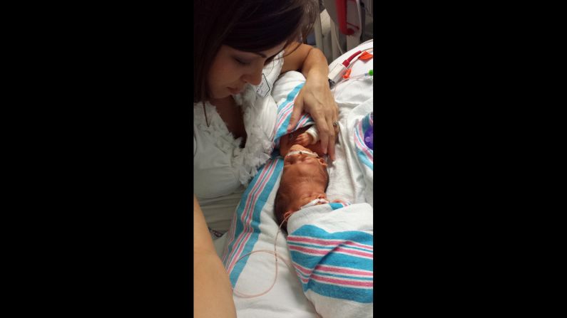 "Don't worry," Nicole McDonald said to her husband when she told him about being pregnant with conjoined twins. "We'll figure it out."