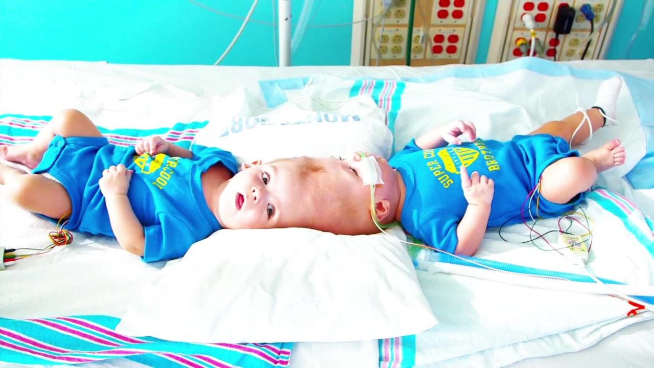 The parents' worries extend beyond the surgery; they wonder what happens in recovery.