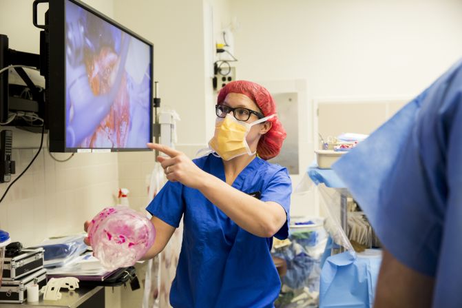 Goodrich's team worked more than 16 hours just to separate the boys, and each continued surgery individually afterward.