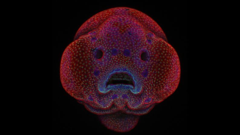 <strong>1st Place:</strong> <strong>Dr. Oscar Ruiz</strong> -- A photo of a four-day-old zebrafish embryo claimed top honors in the annual Nikon Small World Photomicrography Competition. Image produced at the University of Texas' Anderson Cancer Center in Houston, Texas. 