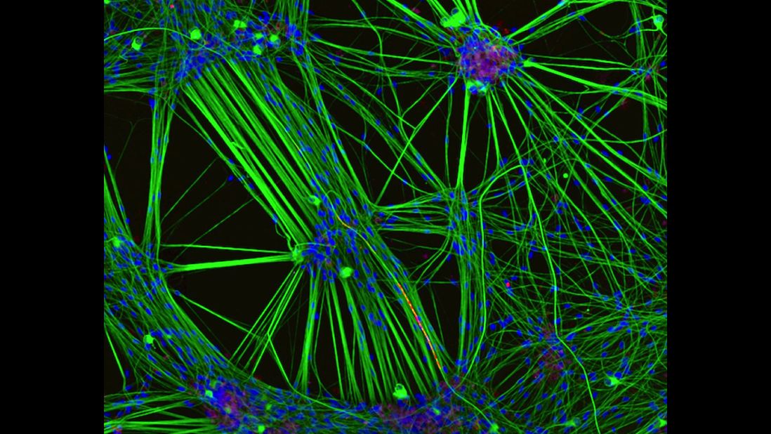 <strong>3rd Place:</strong> <strong>Rebecca Nutbrown -- </strong>A culture of neurons (stained green) derived from human skin cells, and Schwann cells, a second type of brain cell (stained red). Photo taken at the University of Oxford, Nuffield Department of Clinical Neurosciences in Oxford, United Kingdom. <br />