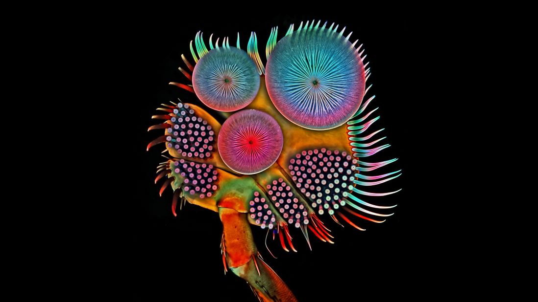 <strong>5th Place:</strong> <strong>Dr. Igor Siwanowicz -- </strong>No stranger to the Nikon Small World contest, Igor Siwanowicz -- who took third place in 2015 -- has been recognized again this year for a photo of a front foot (tarsus) of a male diving beetle. The photo was taken at the Howard Hughes Medical Institute, Janelia Research Campus in Ashburn, Virginia, US. 