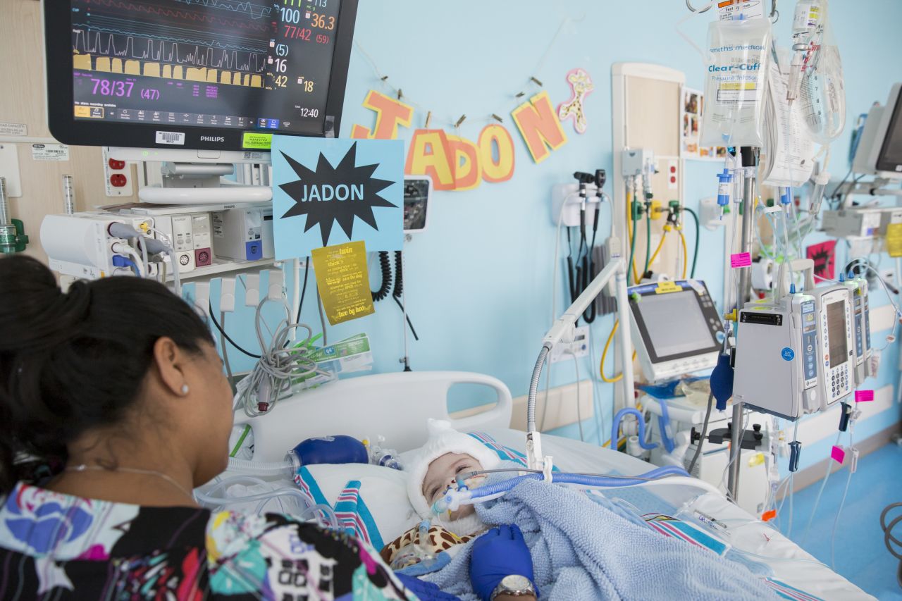 Jadon recovers in the  pediatric intensive care unit  shortly after the surgery.
