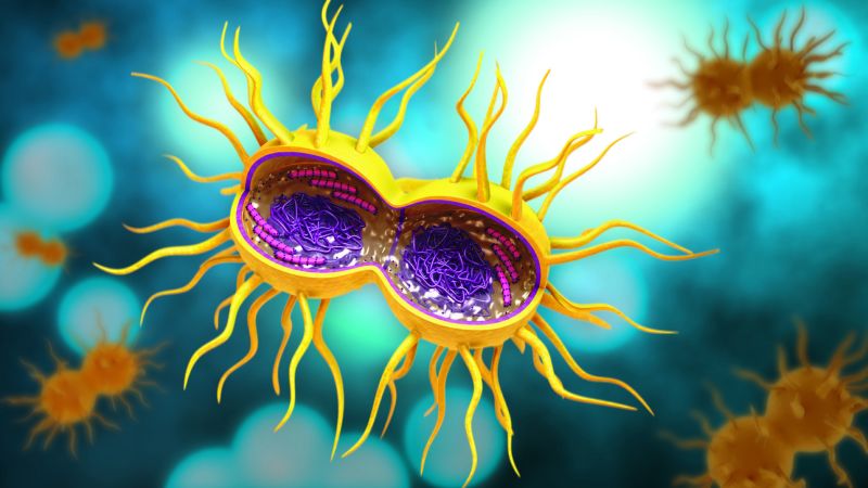 First case of gonorrhea resistant to several classes of antibiotics identified in the United States