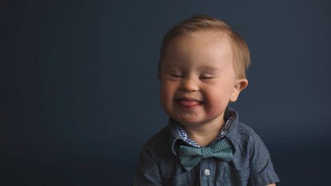 05 Asher child with down syndrome
