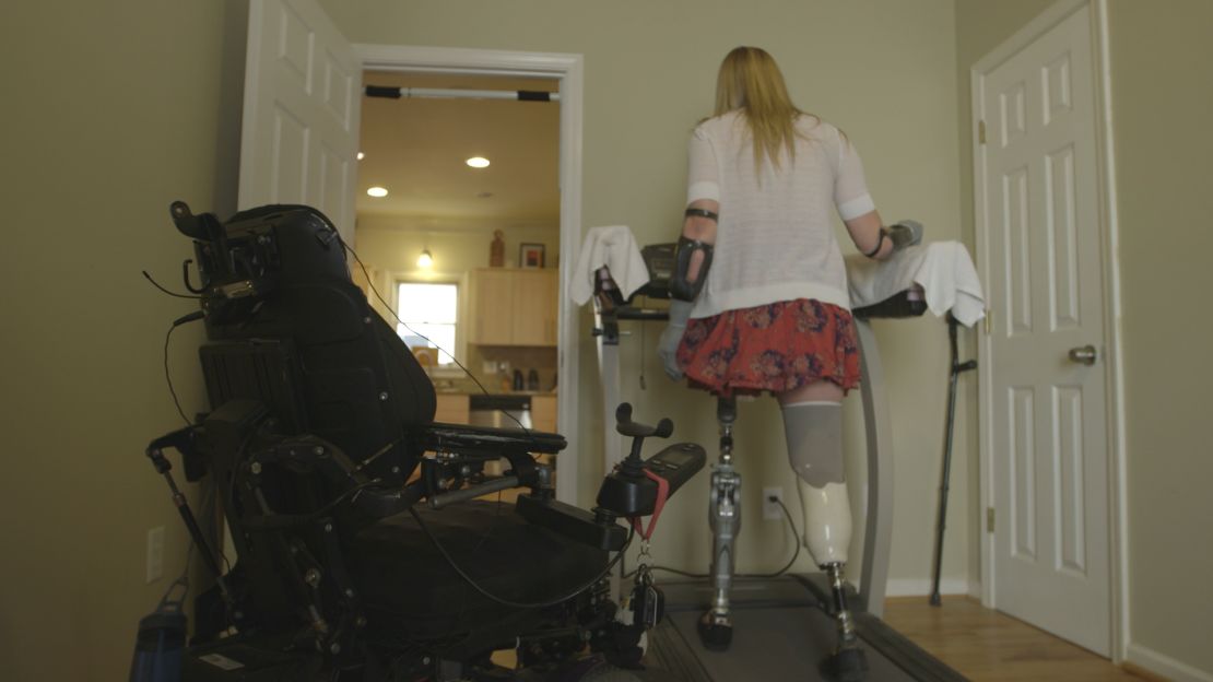Walking now is so difficult, it's largely relegated to the treadmill. She hopes a surgery will one day let her walk more easily.
