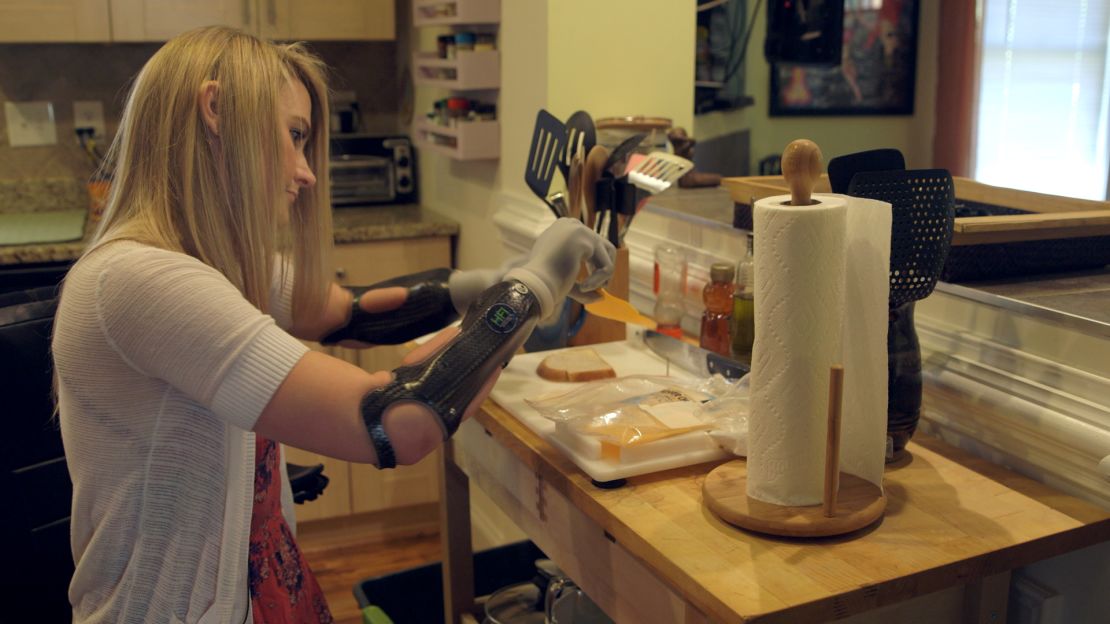 She uses myoelectric hand prostheses for finer movements, like when she's preparing food. "One big reason I wanted to move out of my parents' house was to get my own kitchen," she says. "I love to cook."