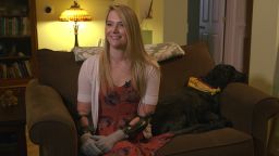 Flesh-eating bacteria survivor Aimee Copeland  sits in her Atlanta home with her dog, Belle, on April 11, 2016.