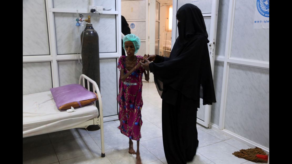 Saida Ahmad Baghili, an 18-year-old Yemeni woman from an impoverished coastal village on the outskirts of the rebel-held Yemeni port city of Hodeidah where malnutrition has hit the population hard.