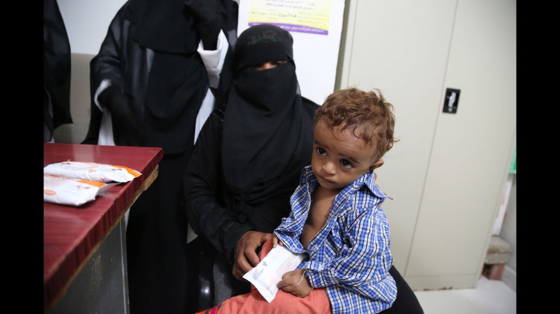 A 3-year-old is treated in Hajjah. In some areas, malnutrition among children under 5 is at a high.