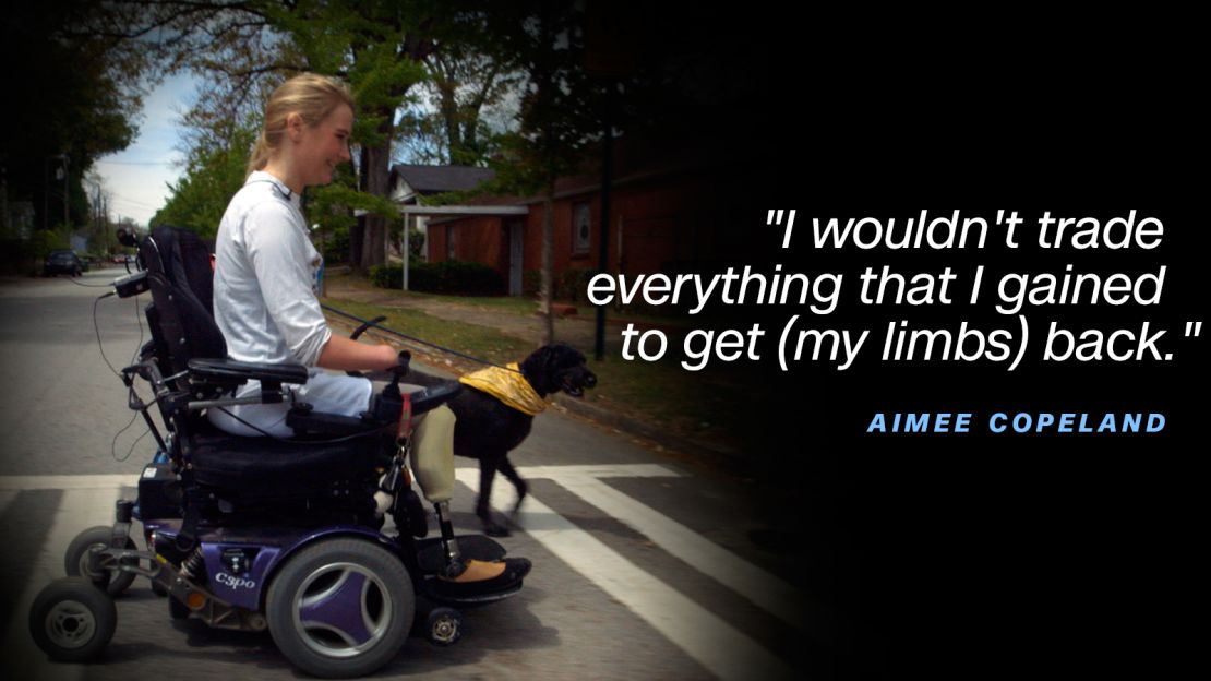 Aimee Copeland quote wouldn't trade