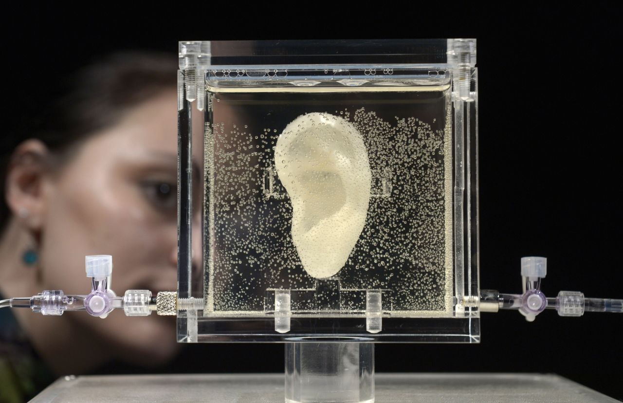  A living replica of Van Gogh's famously severed ear at a German museum in 2014.
