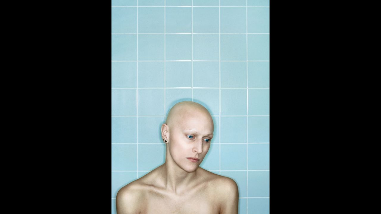 Self Portrait, Chemo 7th Cycle II, April, 2006