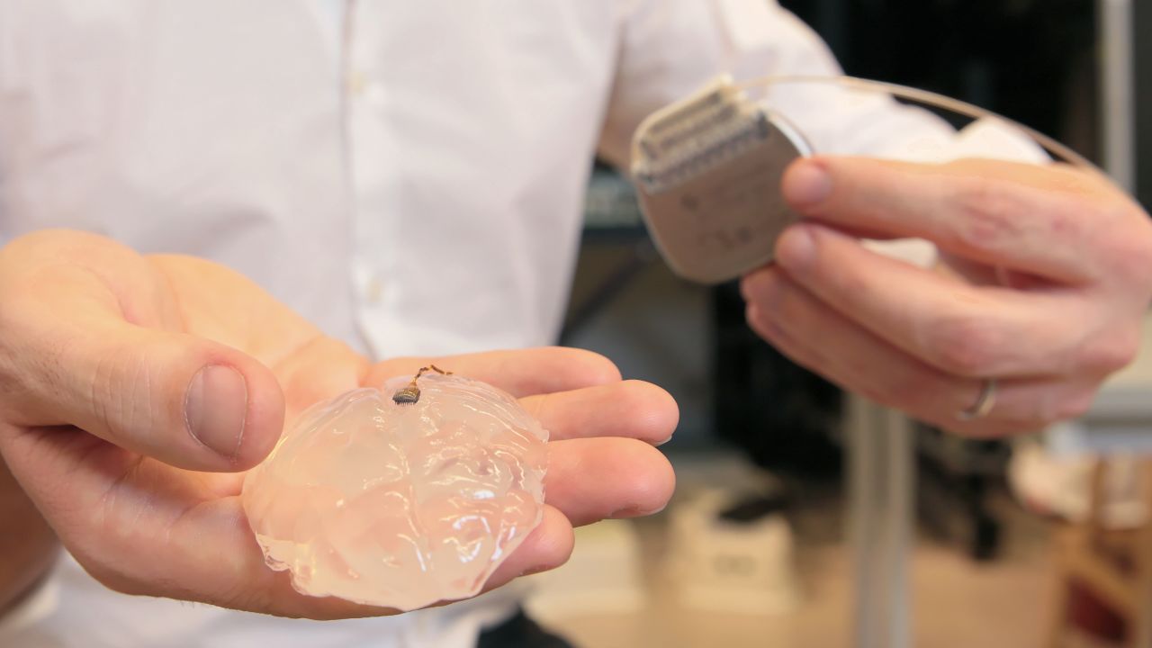 The implant consists of nearly 100 electrodes, surgically placed over the monkey's motor
cortex (here, a silicon model of a primate brain).
