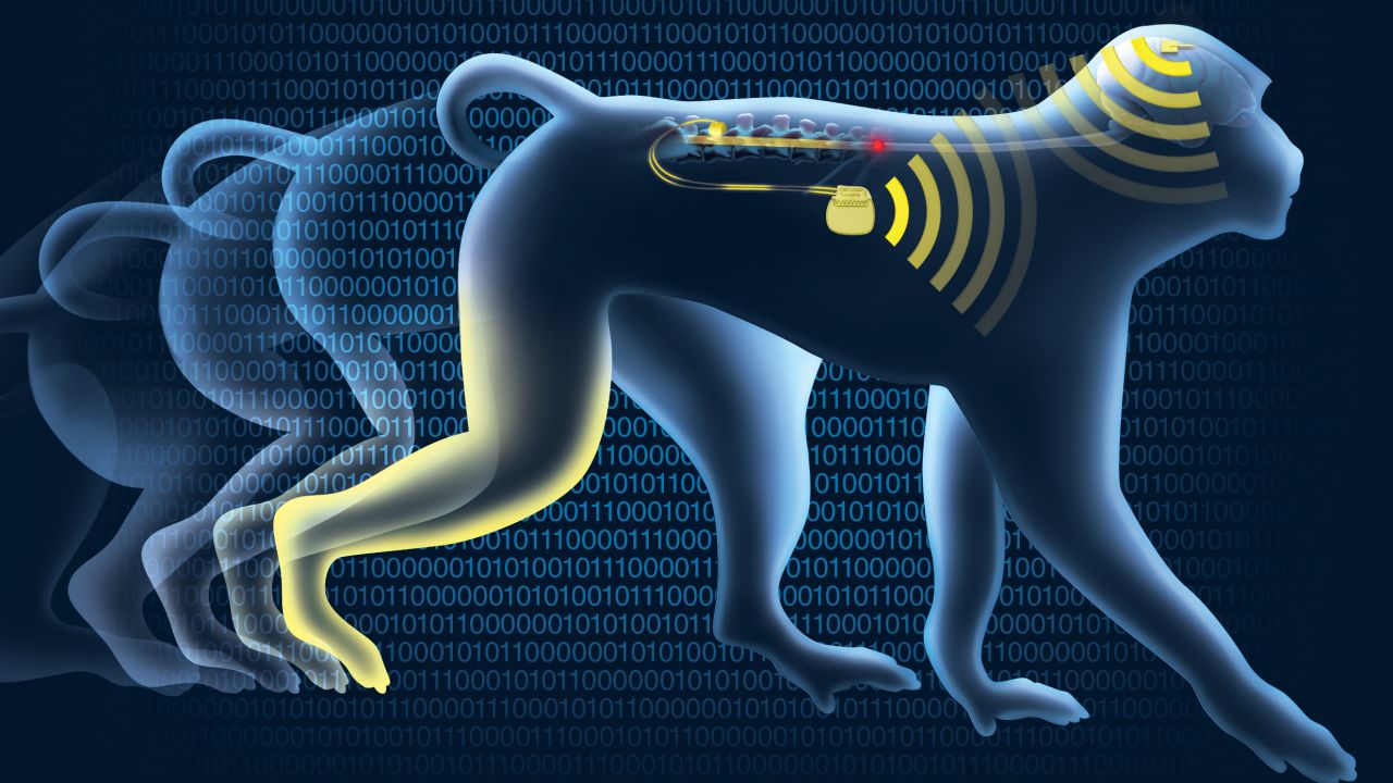 The implants transmit signals wirelessly.