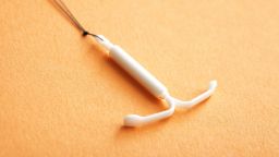 02 birth control IUD