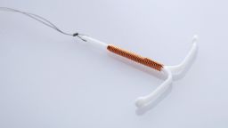 03 birth control IUD