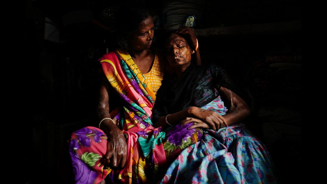 Gita holds her blind daughter, Nitu, for a portrait. Gita's other daughter, Krishna, was killed in the acid attack.