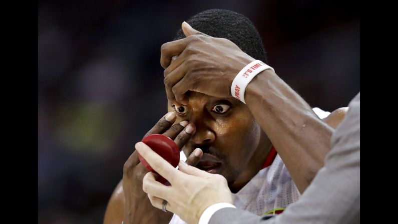Dwight Howard adjusts a contact lens on the sideline during an NBA basketball game in Atlanta on Saturday, November 12.