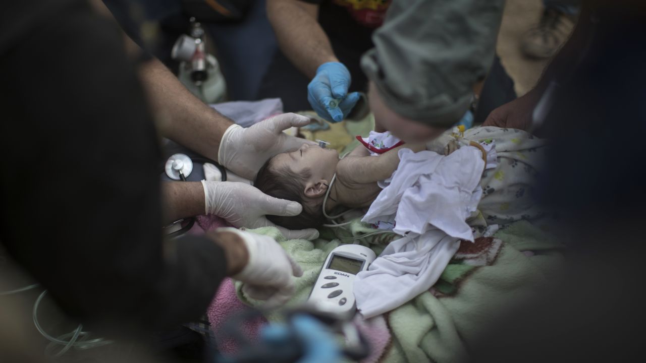 An injured baby receives treatment at a field hospital in Mosul on November 15.