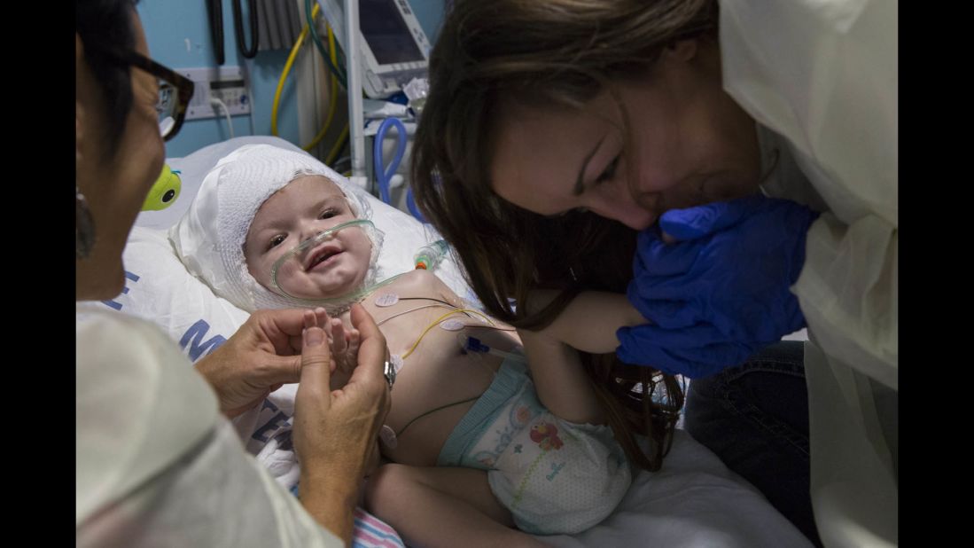 Nicole McDonald, right, and her mother, Chris Grosso, with Anias in mid-November. Anias had to have his skull cap removed due to infection, but doctors say they are still pleased with his recovery. 