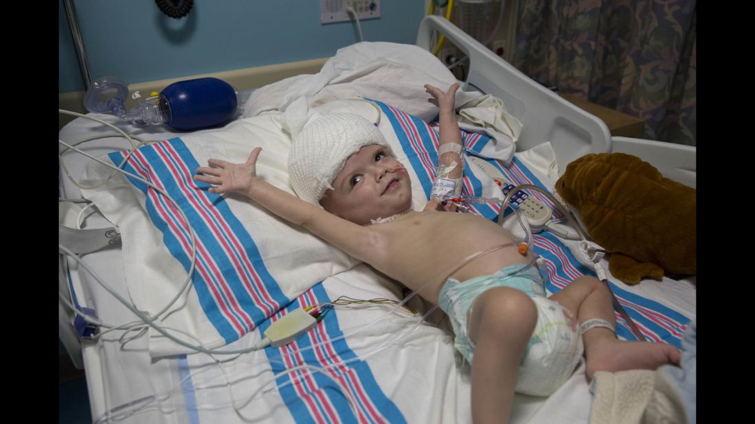 Jadon stretches his arms in his room within the hospital's pediatric intensive care unit. Anias rests in a nearby bed in the same room.