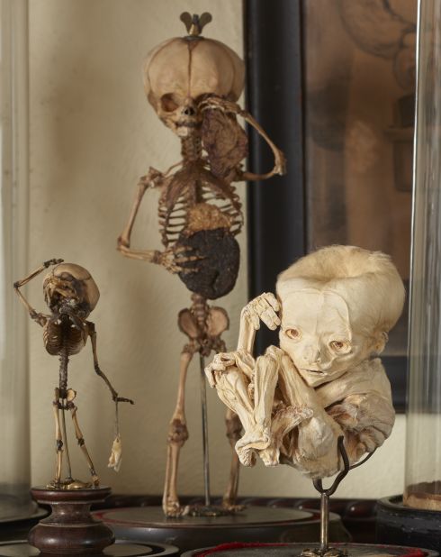 "I am an obsessive collector and dealer ... with a concentration on rare, medical, scientific, and anthropologically related antiquities," Cohn says. <br /><br />These 19th-century fetal skeletons, and the calcified fetus seen on the right, are just a small part of his collection. 