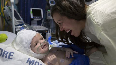 Nicole McDonald laughs with son Anias as he recovers from separation surgery.