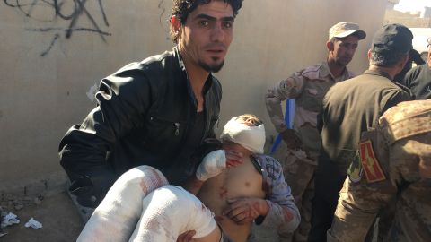 A wounded child is treated at a military triage center in Mosul before being transferred to a hospital nearby.