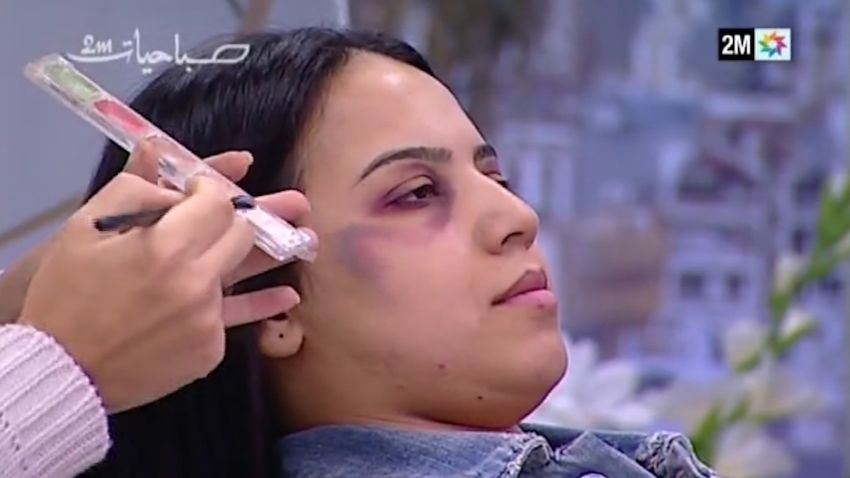 domestic violence makeup morroco tv