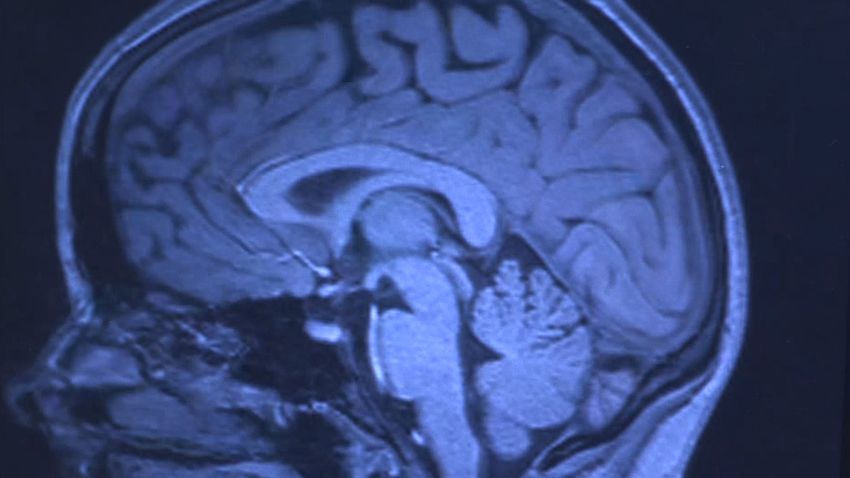 brain scan mri religion