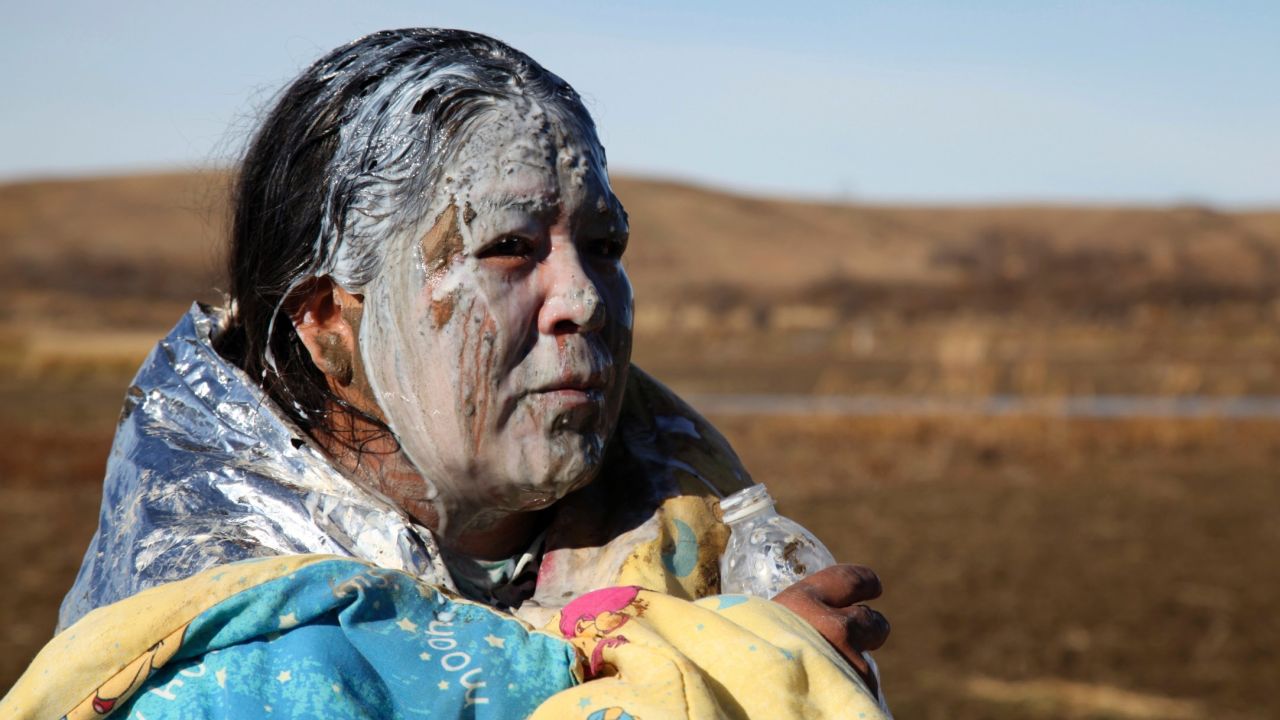 Tonya Stands recovers after being pepper-sprayed by police on Wednesday, November 2. Stands was pepper-sprayed after swimming across a creek with other protesters hoping to build a new camp to block construction of the Dakota Access Pipeline.
