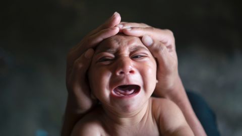 <strong>January 30:</strong> Jose Wesley, a baby born with microcephaly, cries in Bonito, Brazil. Microcephaly is a neurological disorder that results in newborns with small heads and abnormal brain development. <a href="http://www.cnn.com/2016/01/26/health/gallery/zika-virus/index.html" target="_blank">An outbreak of the Zika virus</a> was linked to a surge of babies with the birth defect.