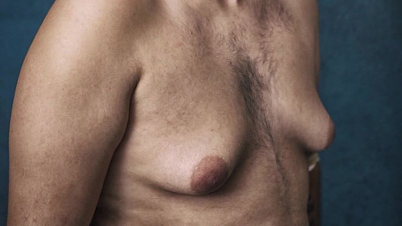 girlfriend forced me to grow breasts