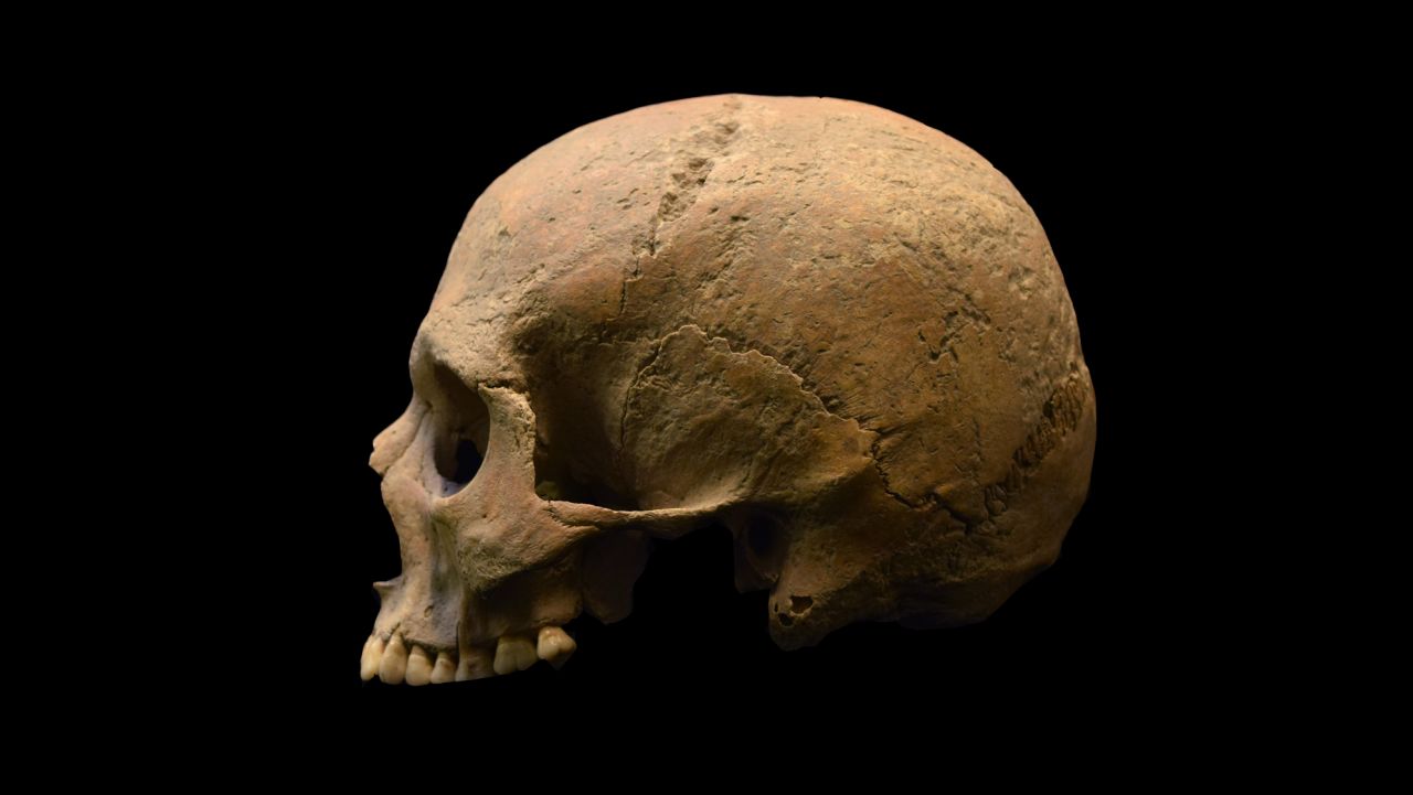 Skeletal remains of an individual from Velia, Italy are shown.